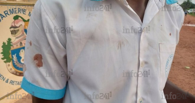 Une bagarre générale entre deux lycées de Port-Gentil fait plusieurs blessés graves
